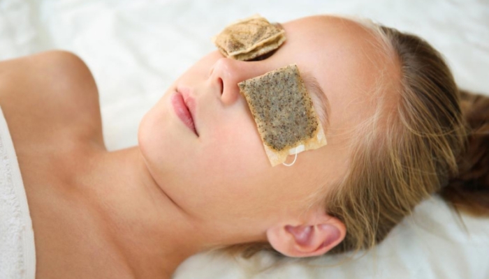 tea bags for eyes infection